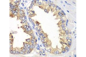 Immunohistochemistry of paraffin-embedded Human prostate using KLK10 Polyclonal Antibody at dilution of 1:100 (40x lens). (Kallikrein 10 antibody)