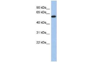 Human PANC1; WB Suggested Anti-ZNF496 Antibody Titration: 0.