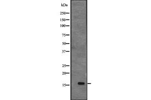Western blot analysis of CENPS expression in MHF1 transfected 293T cell lysate;,The lane on the left is treated with the antigen-specific peptide. (APITD1 antibody  (C-Term))