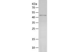 TUBB3 Protein (AA 1-450) (His tag)