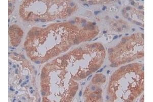 Detection of C5a in Human Kidney Tissue using Polyclonal Antibody to Complement Component 5a (C5a) (C5A antibody  (AA 678-751))