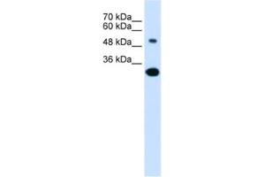 Western Blotting (WB) image for anti-Solute Carrier Family 2 (Facilitated Glucose/fructose Transporter), Member 5 (SLC2A5) antibody (ABIN2462527) (SLC2A5 antibody)