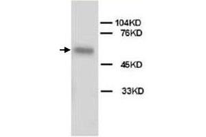 Western Blot analysis of ALPL expression from HeLa cell lyate with ALPL polyclonal antibody . (ALPL antibody  (N-Term))