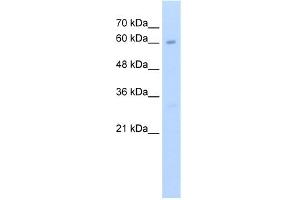 WB Suggested Anti-KIAA0859 Antibody Titration:  2. (METTL13 antibody  (C-Term))