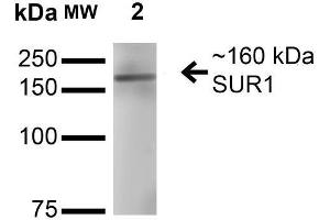 Western Blot analysis of Rat Brain Membrane showing detection of ~160 kDa SUR1 protein using Mouse Anti-SUR1 Monoclonal Antibody, Clone S289-16 . (ABCC8 antibody  (AA 1548-1582))