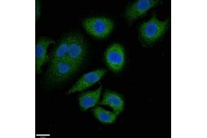 Immunofluorescent analysis of A549 cells using ABIN7144908 at dilution of 1:100 and Alexa Fluor 488-congugated AffiniPure Goat Anti-Rabbit IgG(H+L) (ABCC9 antibody  (AA 560-669))