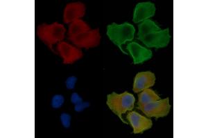 ABIN6260022 and ABIN6276440 staining Hela cells(30 min of UV treatment) by IF/ICC.
