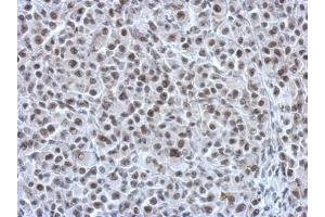 IHC-P Image Immunohistochemical analysis of paraffin-embedded HBL435 xenograft, using RAD21, antibody at 1:750 dilution. (RAD21 antibody  (Center))