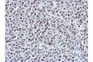 IHC-P Image Immunohistochemical analysis of paraffin-embedded HBL435 xenograft, using RAD21, antibody at 1:750 dilution. (RAD21 antibody  (Center))