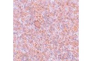 Immunohistochemistry (IHC) image for anti-Retinoblastoma Binding Protein 8 (RBBP8) (Middle Region) antibody (ABIN1031055) (Retinoblastoma Binding Protein 8 antibody  (Middle Region))