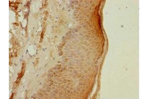Immunohistochemistry of paraffin-embedded human skin tissue using ABIN7164977 at dilution of 1:100 (PSMB3 antibody  (AA 1-205))