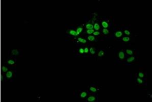 Immunofluorescent analysis of HepG2 cells (sodium butyrate, 30 mM, 4h) using ABIN7139172 at dilution of 1:100 and Alexa Fluor 488-congugated AffiniPure Goat Anti-Rabbit IgG(H+L) (Histone H1.1 antibody  (acLys21))