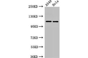 Western Blot Positive WB detected in: A549 whole cell lysate, Hela whole cell lysate All lanes: EPHA5 antibody at 3 μg/mL Secondary Goat polyclonal to rabbit IgG at 1/50000 dilution Predicted band size: 115, 113, 108 kDa Observed band size: 115 kDa
