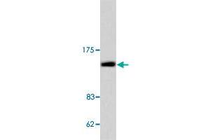 Western blot analysis of COL2A1 polyclonal antibody  in extracts from COLO 205 cell.