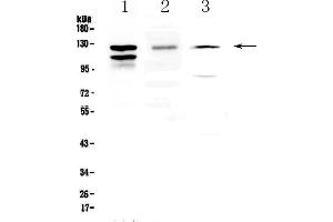Western blot analysis of VE Cadherin using anti-VE Cadherin antibody . (Cadherin 5 antibody  (AA 46-285))