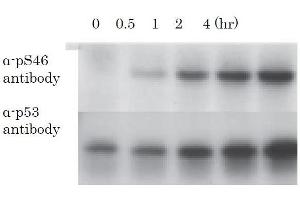 Western Blotting (WB) image for anti-Tumor Protein P53 (TP53) (pSer46) antibody (ABIN3201005)