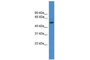 WB Suggested Anti-ZNF277  Antibody Titration: 0. (ZNF277 antibody  (N-Term))