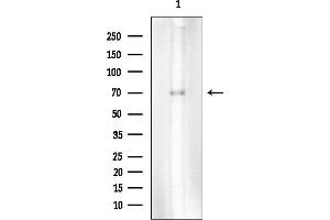 Western blot analysis of lysates from Mouse heart, using YTHDF3 Mouse Monoclonal Antibody at 1/1000 dilution.
