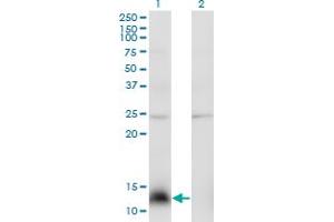 Western Blot analysis of NPY expression in transfected 293T cell line by NPY monoclonal antibody (M01), clone 3B5. (NPY antibody  (AA 29-97))