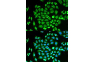 Immunofluorescence analysis of HeLa cells using AKR7A2 antibody. (AKR7A2 antibody  (AA 100-359))