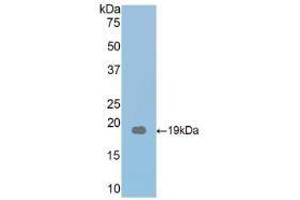 Detection of Recombinant THBS1, Mouse using Polyclonal Antibody to Thrombospondin 1 (THBS1) (Thrombospondin 1 antibody  (AA 515-671))
