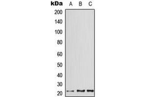 Western blot analysis of ATF3 expression in HeLa (A), mouse heart (B), rat heart (C) whole cell lysates. (ATF3 antibody  (C-Term))