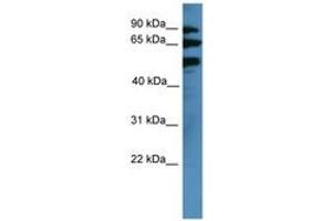 Image no. 1 for anti-Bardet-Biedl Syndrome 2 (BBS2) (AA 315-364) antibody (ABIN6746662) (BBS2 antibody  (AA 315-364))