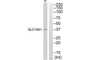 Western blot analysis of extracts from Jurkat cells, using SLC15A1 antibody. (SLC15A1 antibody  (Internal Region))