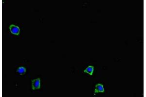 Immunofluorescent analysis of HepG2 cells using ABIN7149644 at dilution of 1:100 and Alexa Fluor 488-congugated AffiniPure Goat Anti-Rabbit IgG(H+L) (GRID2IP antibody  (AA 35-156))