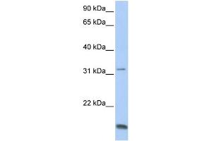 WB Suggested Anti-TCAP Antibody Titration:  0. (TCAP antibody  (N-Term))