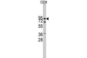 Western blot analysis of CDH10 polyclonal antibody  in CEM cell line lysates (35 ug/lane). (CDH10 antibody  (N-Term))