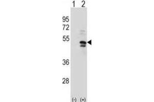 Western Blotting (WB) image for anti-Ubiquitin Specific Peptidase 14 (USP14) antibody (ABIN3001476) (USP14 antibody)