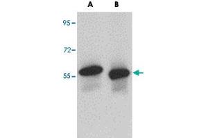 Western blot analysis of SKA3 in human testis tissue lysate with SKA3 polyclonal antibody  at (A) 0.