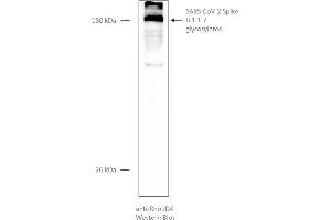 Western Blotting (WB) image for SARS-CoV-2 Spike (B.1.1.7 - alpha) protein (rho-1D4 tag) (ABIN6963742)