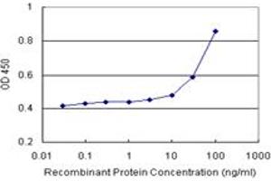 Sandwich ELISA detection sensitivity ranging from 10 ng/mL to 100 ng/mL. (ALDH1A1 (Human) Matched Antibody Pair)