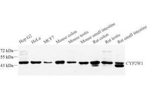Western blot analysis of CYPIW1 (ABIN7073674) at dilution of 1: 1000 (CYP2W1 antibody)