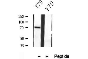 Western blot analysis of extracts of Y79 cells, using MPP5 antibody.