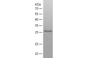 Western Blotting (WB) image for Erythrocyte Membrane Protein Band 4.1 Like 3 (EPB41L3) (AA 3-194) protein (His tag) (ABIN7122816) (EPB41L3 Protein (AA 3-194) (His tag))