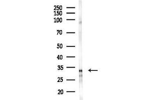 anti-Homeobox D8 (HOXD8) (Internal Region) antibody