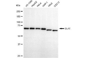 Western blotting analysis using DLAT antibody (ABIN7798336). (Recombinant DLAT antibody)