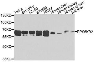Western blot analysis of extracts of various cell lines, using RPS6KB2 antibody. (RPS6KB2 antibody  (AA 1-170))