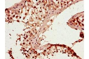 Immunohistochemistry of paraffin-embedded human testis tissue using ABIN7167262 at dilution of 1:100 (RAB25 antibody  (AA 1-210))
