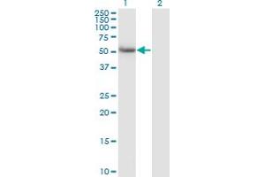 Western Blot analysis of CALCOCO2 expression in transfected 293T cell line by CALCOCO2 monoclonal antibody (M07), clone 1A11. (CALCOCO2 antibody  (AA 347-446))