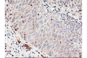 Image no. 1 for anti-LSM1 Homolog, U6 Small Nuclear RNA Associated (LSM1) antibody (ABIN1499210) (LSM1 antibody)