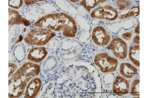 Immunoperoxidase of monoclonal antibody to FTCD on formalin-fixed paraffin-embedded human kidney. (FTCD antibody  (AA 440-541))