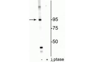 Western blot of HeLa cell lysate showing specific labeling of the ~95 kDa IR protein phosphorylated at Thr1160 in the first lane (-). (Insulin Receptor antibody  (pThr1160))