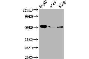Western Blot Positive WB detected in: HepG2 whole cell lysate, A549 whole cell lysate, K562 whole cell lysate All lanes: Factor IX antibody at 1:2000 Secondary Goat polyclonal to rabbit IgG at 1/50000 dilution Predicted band size: 52 kDa Observed band size: 52 kDa (Recombinant Coagulation Factor IX antibody)
