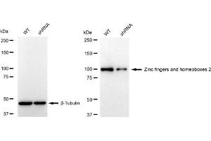 Western blotting analysis using Zinc fingers and homeoboxes 2 antibody (ABIN7800905).