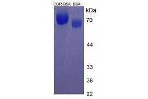 Image no. 2 for Cortisone (COR) protein (BSA) (ABIN1880101) (Cortisone Protein (COR) (BSA))
