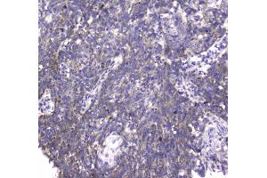 IHC analysis of MRE11 using anti-MRE11 antibody . (Mre11 antibody  (AA 2-239))